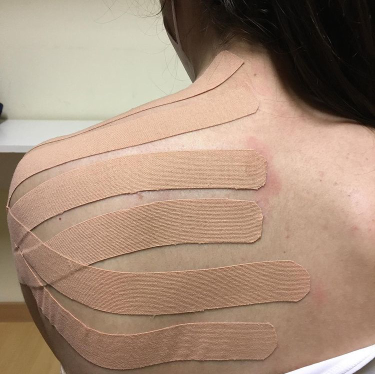 tape neuromuscolare