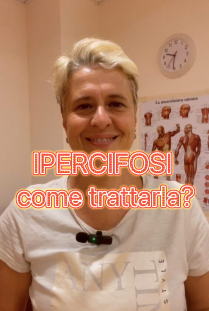 Cos'è l'ipercifosi?