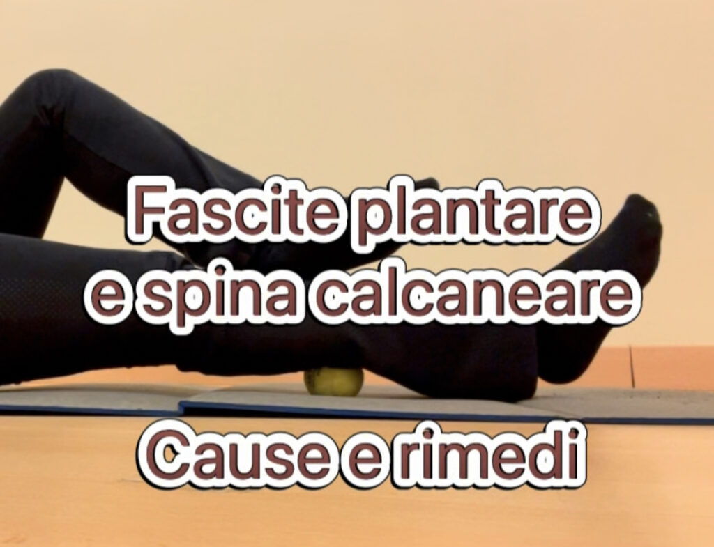 Fascite e spina calcaneare: cause e rimedi