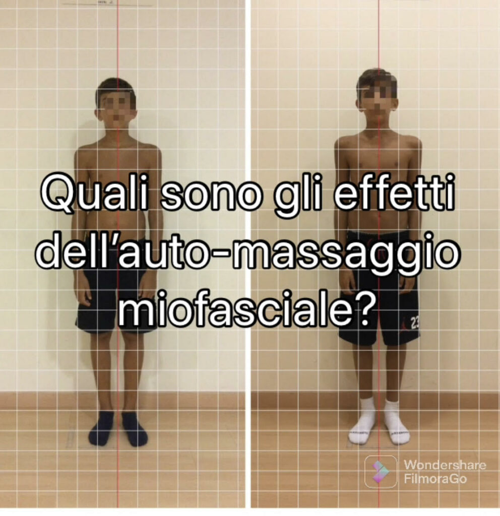 L'auto-massaggio per correggere la postura di bambini e adolescenti